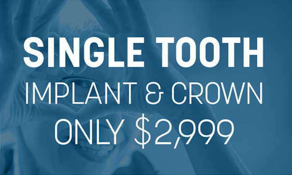 lovett dental humble special offer
