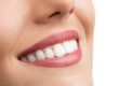 young woman smiling after Professional Teeth Whitening
