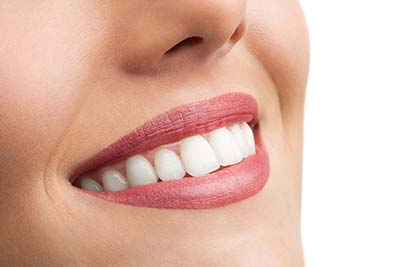 Professional Teeth Whitening young woman smiling after Professional Teeth Whitening
