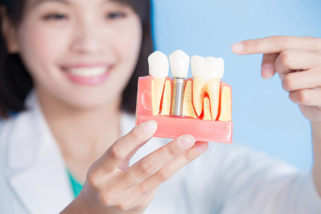 woman dentist take implant tooth dentist holding model of dental implants