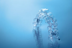 example of clear aligners