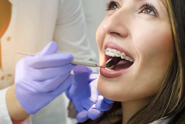 5-Signs-You-Need-Dental-Braces-Again (2) woman getting dental braces